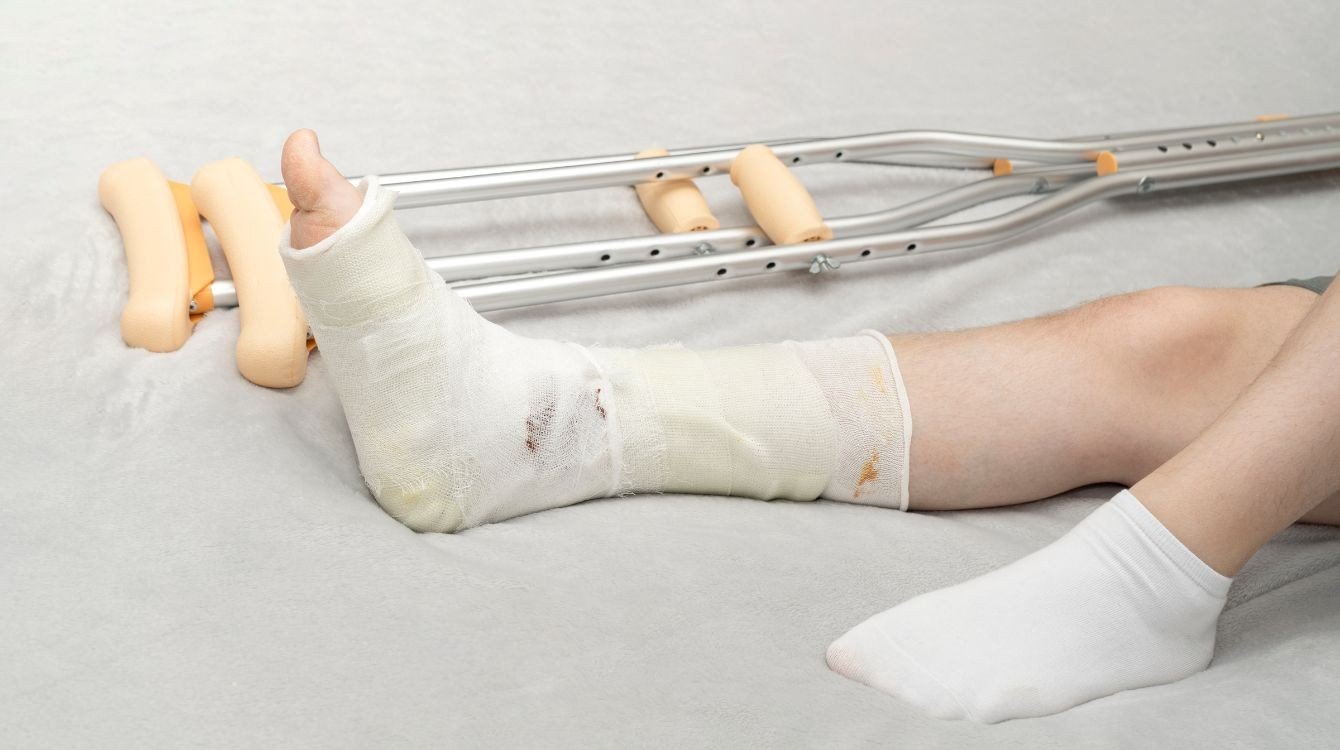 Výše odškodnění po dopravní nehodě či jiném mimopracovním úrazu v roce 2026 výrazně vzroste