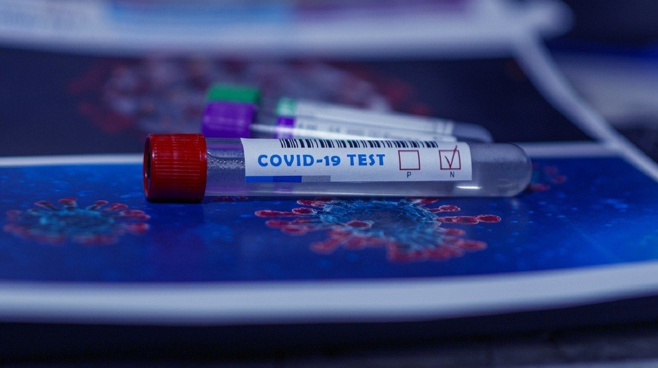 Povinné testování zaměstnanců přezkoumá Nejvyšší správní soud